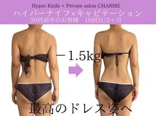 シャルム(charme)/ブライダルにハイパーナイフ痩身