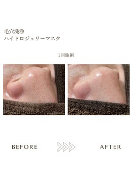 サロンエイトミー 西船橋店(salon 83)/ジェリーマスク/before→after
