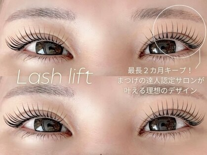 アフェット(affetto)の写真