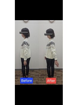 最後の整体 練馬駅前院/腰痛でお悩みの方の体の可動域