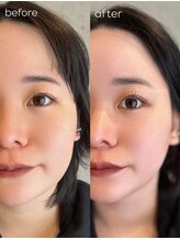 グロウ(Grow)/まつ毛パーマ【まつ毛/眉毛】