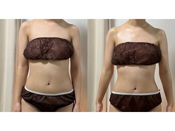 リュミエール(Lumiere)/くびれメイク