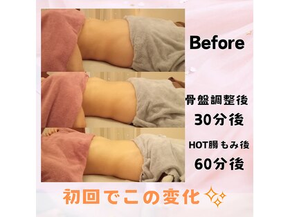 スイスパ(SUII SPA)の写真