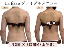 ラエッセ(La Esse)/ブライダル*背中すっきり