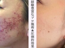 ビ ボーテ(美 Beaute)の雰囲気(【ハーブピーリング】REVI陶肌トリートメントで肌のお悩み解消♪)