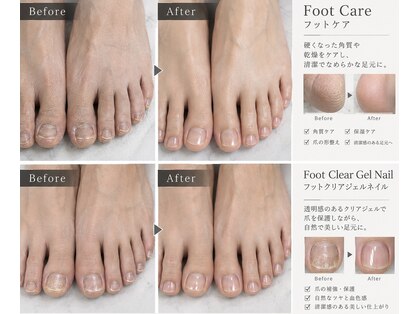 ジェンティー(GENTY)の写真
