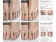 ジェンティー(GENTY)の写真