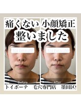 トイボーテ(toi beaute)/小顔になりたい方必見！