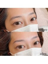 ダリ(Dali)/ハリウッドブロウリフト