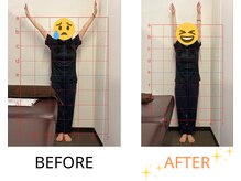 ベル/20代の方の姿勢Before After