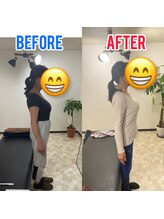 Rストレッチ/【姿勢改善】ビフォーアフター