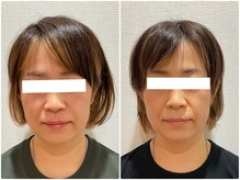 美容整体ウェリナ あま甚目寺院/小顔矯正/骨盤矯正/美脚サロン