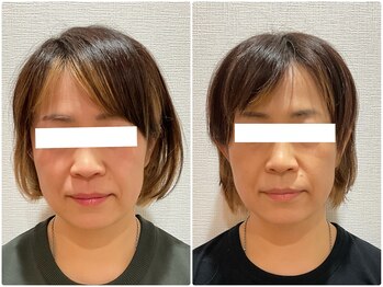 美容整体ウェリナ あま甚目寺院/小顔矯正/骨盤矯正/美脚サロン