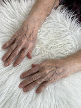 サナ 久が原 千鳥町(S’ana)/ハンドスペシャルケア