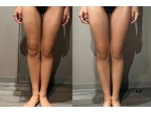 サロンスペース/30代 女性【美脚・美尻 1回目】