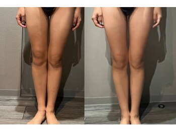 サロンスペース/30代 女性【美脚・美尻 1回目】