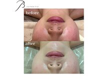 ビー エステティック(B ESTETIC)の雰囲気（長年のお肌悩みを改善★ケア方法や食事から肌質改善を叶えます！）