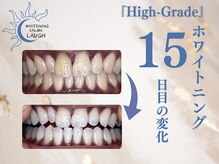 ラフ(LAUGH)/【審・美・白】 ホワイトニング