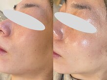 トトノエ(TOTONOE)/クリスティーナ-ビオフィート-