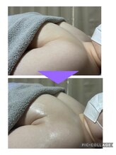 ハーグレイス 表参道外苑前(Her Grace)/バストアップ/バストケアBA