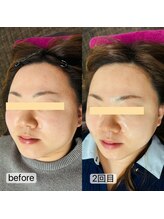 トゥインクル(Twinkle)/ツヤツヤ、スッキリ♪