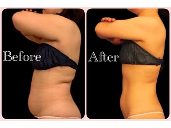 トータルビューティサロン クイーン(Queen)の写真/【美やせ認定サロン】若かりしあの頃の体型へ!医療提携＆美やせプログラムで40代以上の本気痩せ叶えます