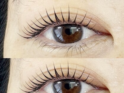 パトラ(PATRA)の写真