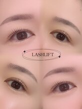 リリーアイ(Liley eye.)