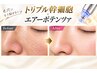 【エアーポテンツァ】トリプル幹細胞使用☆本気の『肌チェンジ』　￥8,800
