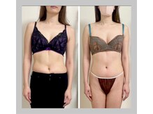 蒼(so)/側湾症&バスト左右差・5回で改善