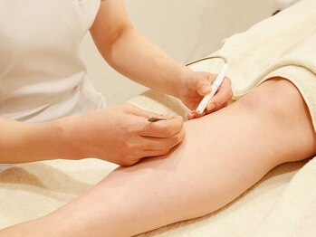 サロン ド ソレイユ(Salon.de.Soleil)の写真/【美容電気脱毛】大好評★1本1本ピンポイント脱毛で自己処理から解放◎いつまでも無くならない不要な毛に！