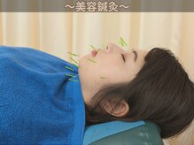 与野駅前鍼灸整骨院/美容鍼でエイジングケア