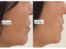 シフク鍼灸整体院/５０代(加工なし)