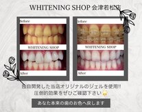 ホワイトニングショップ 会津若松店