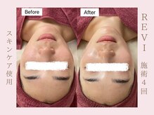 ルア(LuA.)/艶々お肌♪