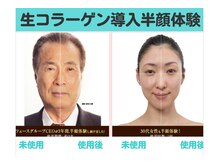 ナナ 銀座(Nana)/世界特許の生コラーゲンは秋に