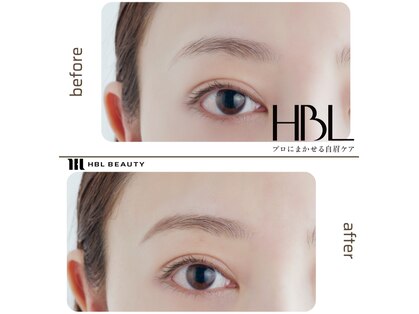 リンネ(Rinne)の写真