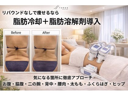 スリー(THREE)の写真