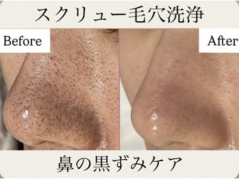 ムーン 高崎店(MOON)の写真/【"セルマンフェイシャル"で肌の変化を実感♪】毛穴の開きや黒ずみを徹底ケアし、つるぴか陶器肌に◎