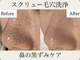ムーン 高崎店(MOON)の写真/【"セルマンフェイシャル"で肌の変化を実感♪】毛穴の開きや黒ずみを徹底ケアし、つるぴか陶器肌に◎