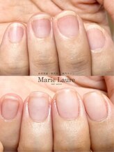 マリーロール 梅田店(Marie Laure)/自爪育成/深爪矯正/ネイルケア