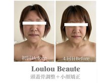 ルルボーテ(Loulou Beaute)/頭蓋骨調整＋小顔矯正