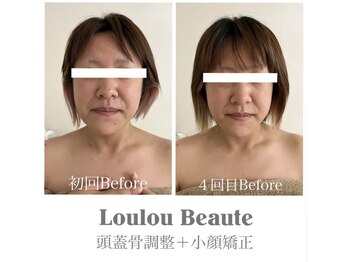 ルルボーテ(Loulou Beaute)/頭蓋骨調整+小顔矯正