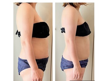 ミニョン(mignonn.)/