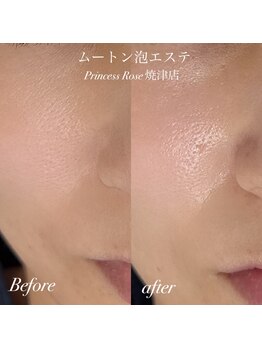 プリンセスローズ 焼津店(Princess Rose)/ムートン泡エステ