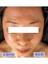 ボディーワークスナビ(Body Works Navi)/40代たるみ改善・ほうれい線ケア