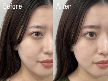 ワクシー 中目黒(WAXYYY.)/自然ハリウッドブロウリフト