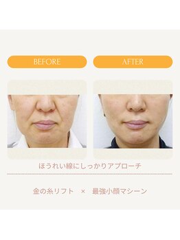 ムーンライズ(moonrise)/