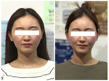 シンメトリー 麻布十番/Before/After