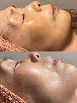 ヴィーナス(Venus)/白玉スキン